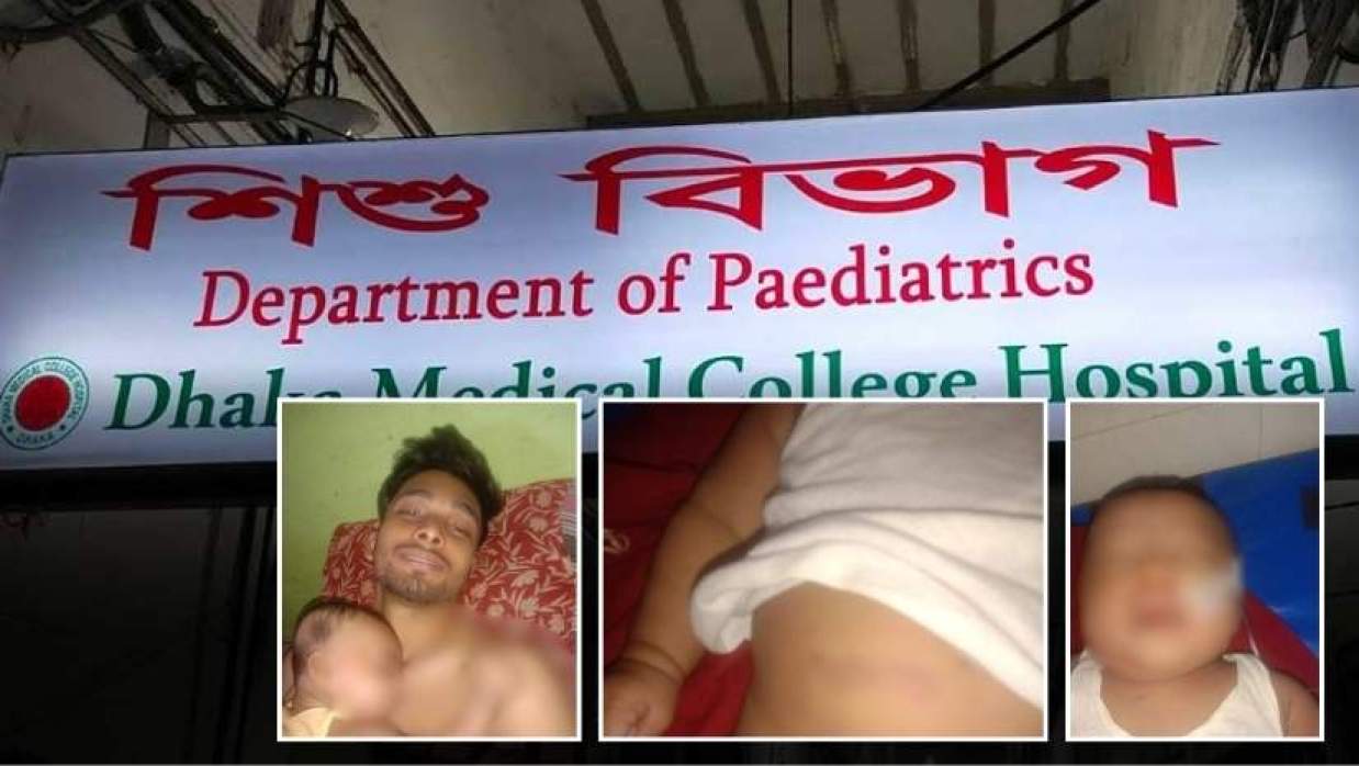 ঢামেক হাসপাতালের শিশু নিবিড় পরিচর্যা কেন্দ্রে চিকিৎসা নিচ্ছে শিশুটি—নিচে তার বাবা হৃদয় খান ও পাশে চিকিৎসাধীন শিশুটির শরীরে আঘাতের চিহ্ন