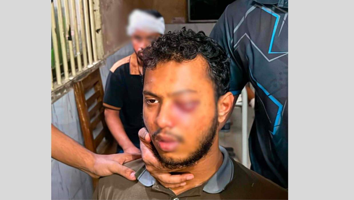 গুরুতর আহত শিক্ষার্থী শাহ তাফসির আহমেদ