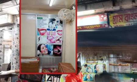 লাইসেন্সবিহীন ডেন্টাল ক্লিনিকে রুট ক্যানাল-অস্ত্রোপচার, ঝুঁকিতে রোগীরা