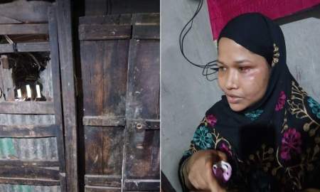চুরি করতে এসে গৃহবধূর কামড়ে আঙুল হারাল চোর, অতঃপর...