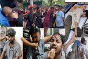 জবিতে ছাত্রদলের দফায় দফায় হামলায় জকসুর ভিপি-জিএস, সাংবাদিক,…