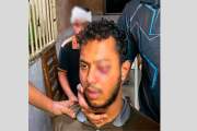মেডিকেল কলেজে সংঘর্ষে আহত সেই শিক্ষার্থীর দৃষ্টিশক্তি হারান…
