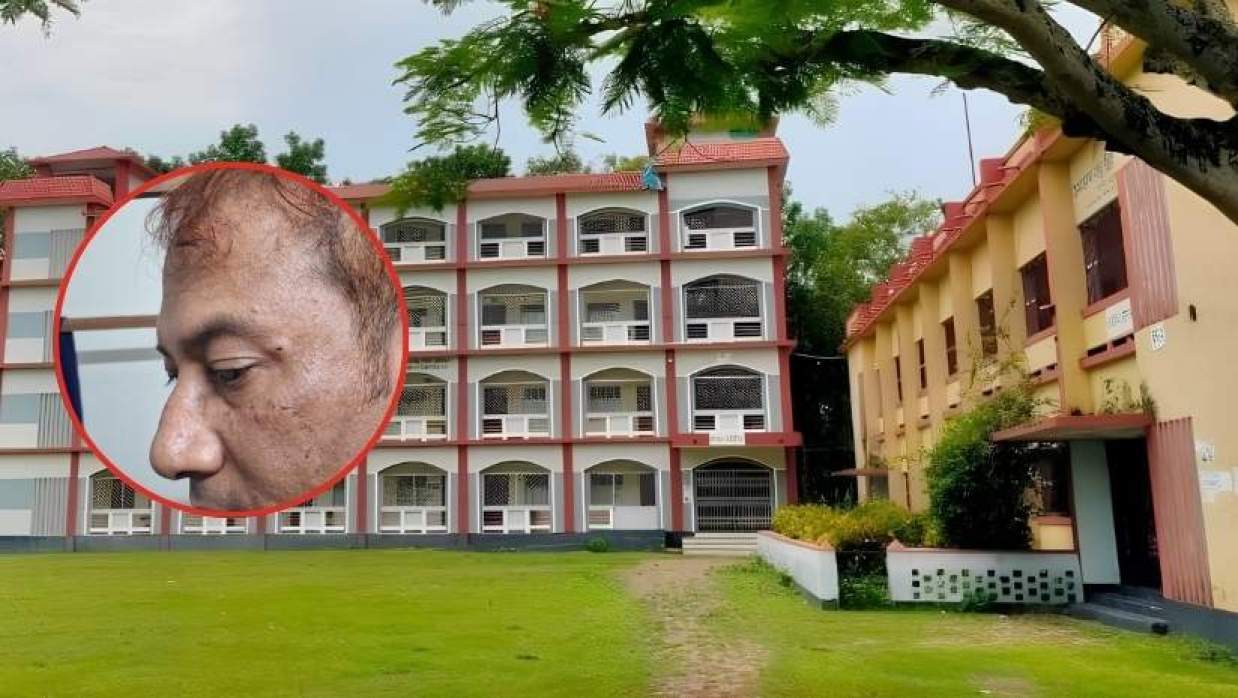 অমরেশ বসু ডিগ্রি কলেজের অধ্যক্ষের ওপর হামলার অভিযোগ