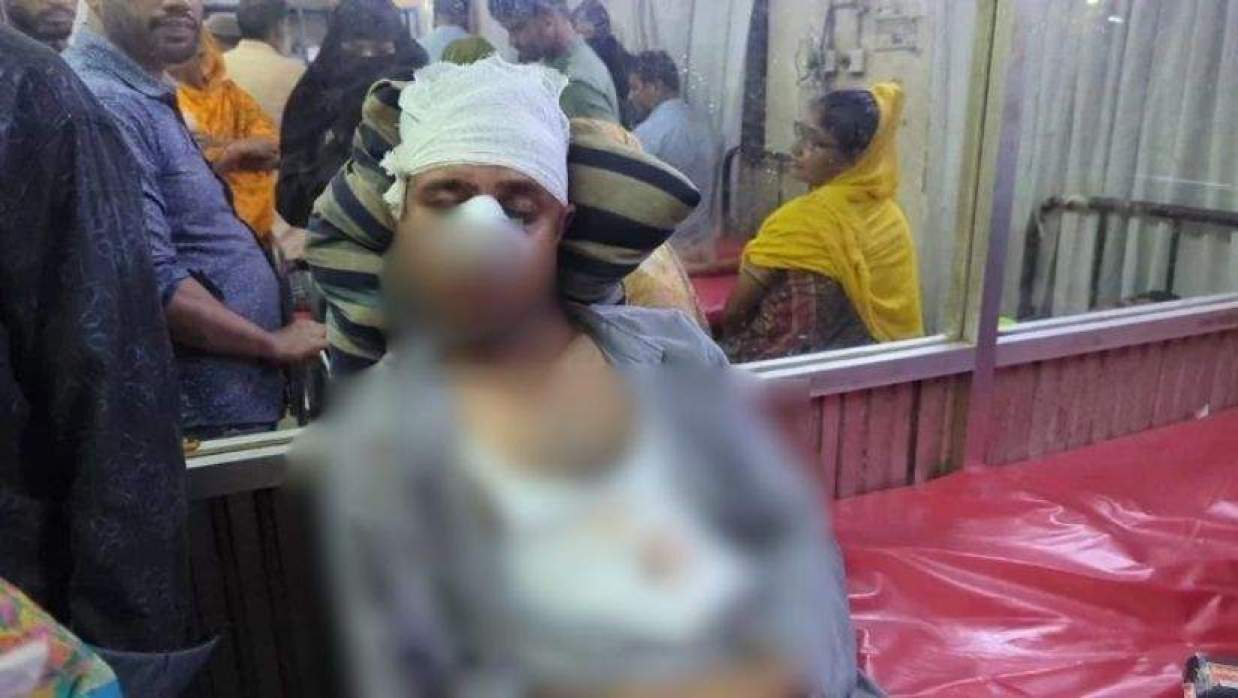 আহত জামায়াত নেতা