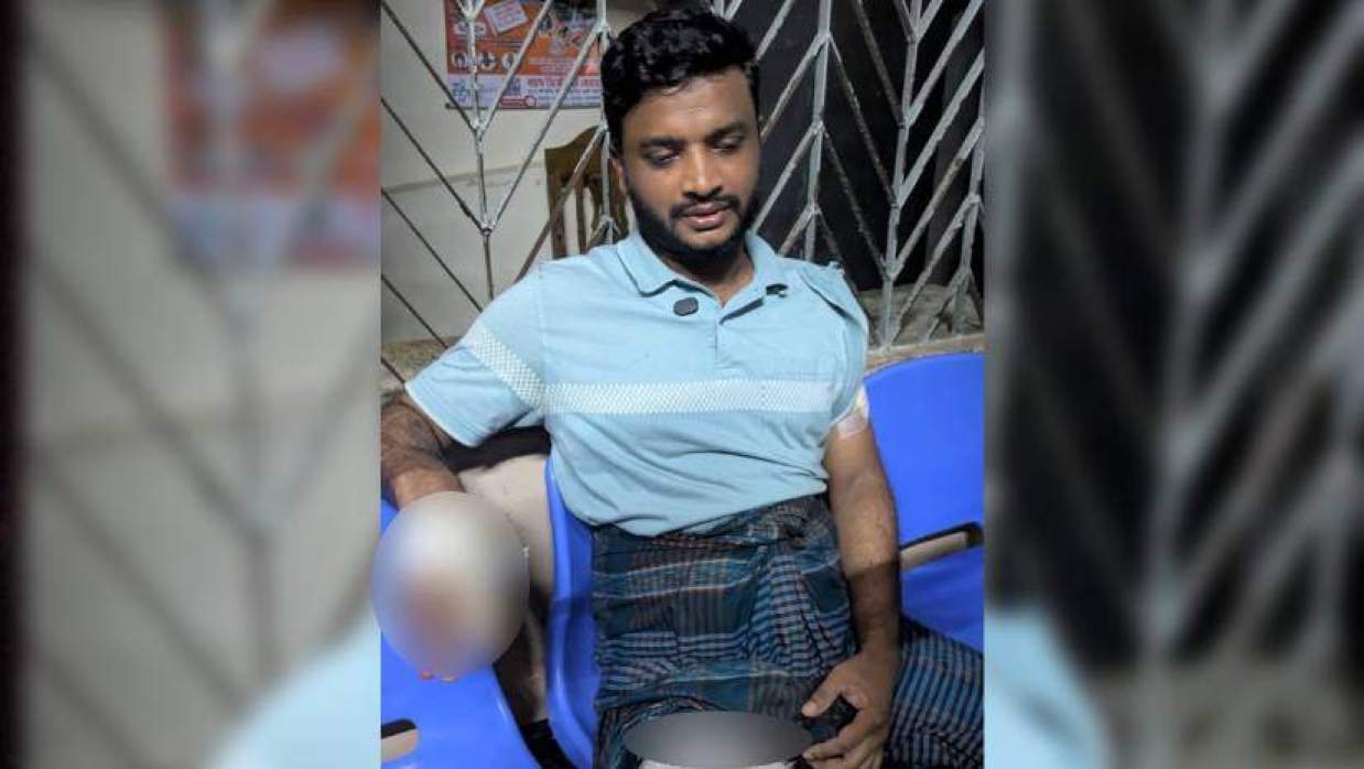 ছুরিকাঘাতে আহত নজরুল ইসলাম মানিক