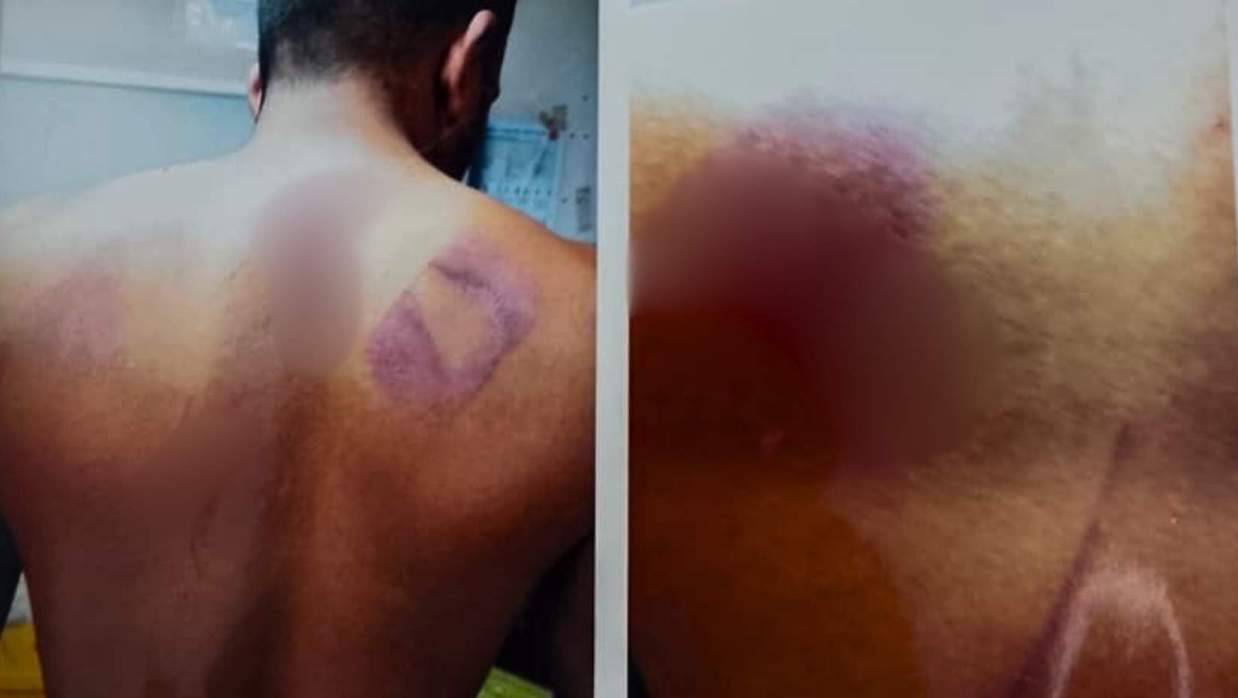 দাওয়াতের কথা বলে শিক্ষককে ডেকে নিয়ে পেটানোর অভিযোগ, মামলার আবেদন