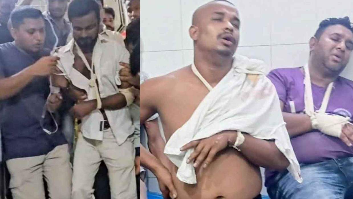 আহত নেতাকর্মীরা হাসপাতালে ভর্তি