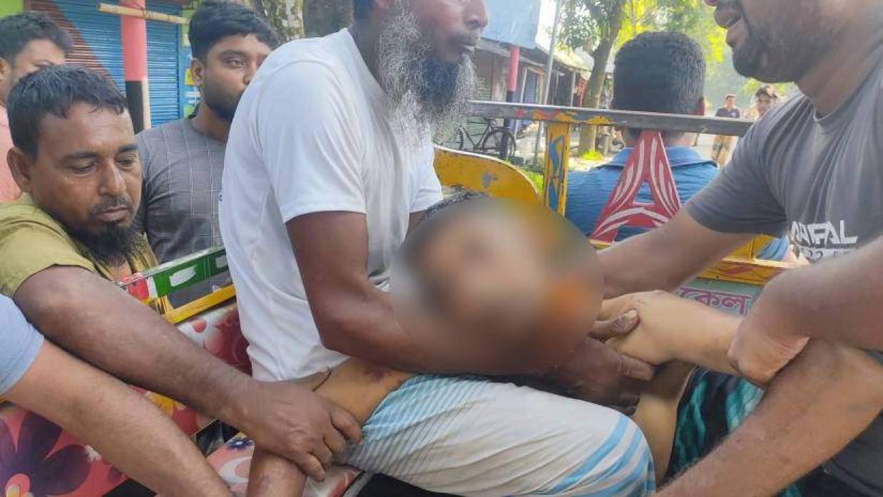 বিদ্যুৎস্পৃষ্টে আহত মুকিন উদ্দিনকে হাসপাতালে নেওয়া হচ্ছে
