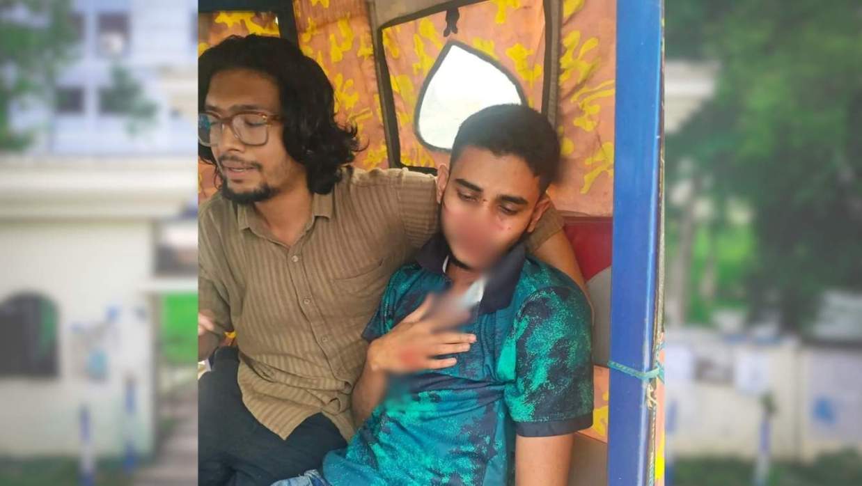 ছাত্রসমিতি নির্বাচন ঘিরে সিকৃবিতে শিক্ষার্থীর উপর ছাত্রদল নেতার হামলার অভিযোগ