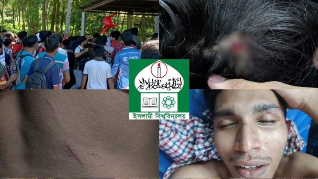 ইবিতে আন্তঃবিভাগ ও আন্তঃহল সমূহের মধ্যে অনুষ্ঠিত ফুটবল টুর্নামেন্ট খেলাকে কেন্দ্র করে সংঘর্ষ