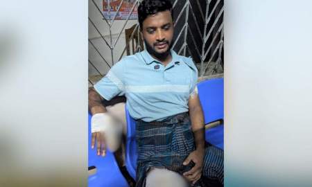 ‘তুই আমাদের ছেলেকে পুলিশের হাতে তুলে দিয়েছিস কেন’— প্রশ্ন করেই স্কুল শিক্ষককে এলোপাতাড়ি ছুরিকাঘাত