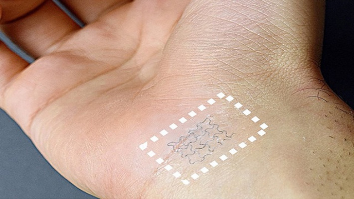 আসছে স্মার্ট স্টিকার; যা রোগের সতর্কবার্তা দিবে