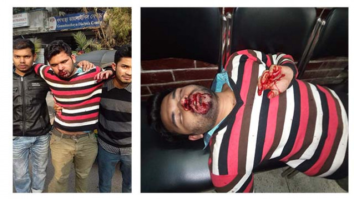 নিরাপদ বাংলাদেশ চাওয়ায় ছাত্রলীগের হামলা, আহত ১০