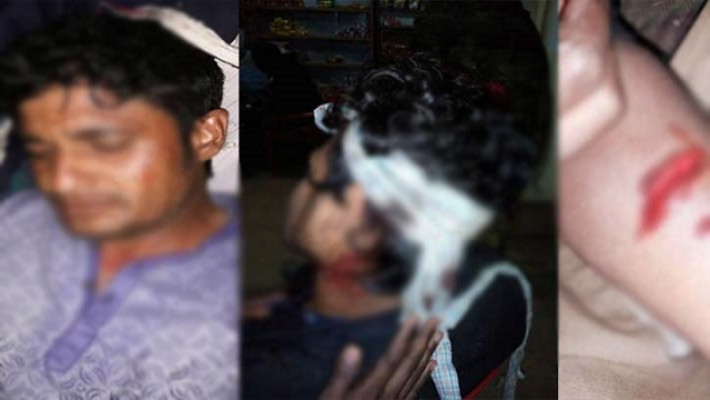 রাঙামাটিতে পাঁচ ছাত্রলীগ কর্মীকে কুপিয়ে জখম