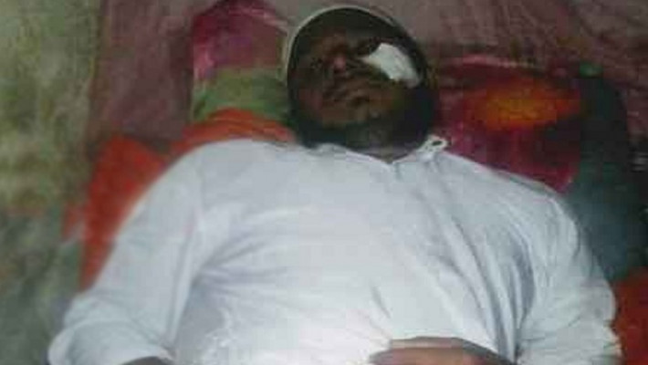 আহত শিক্ষক