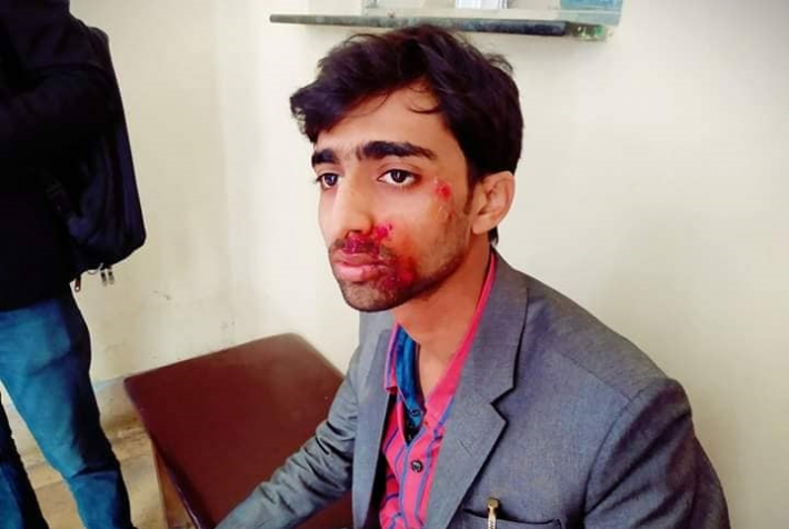 মোটর সাইকেলের ধাক্কায় রাবি শিক্ষার্থী আহত