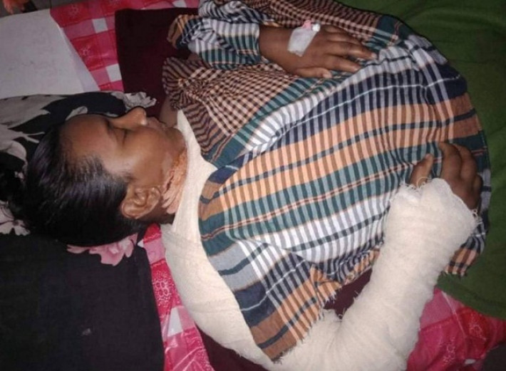 অগ্নিদগ্ধ আরিফা