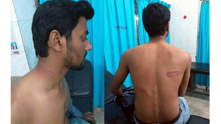হাসপাতালে আহত ছাত্র শামিম আহম্মেদ