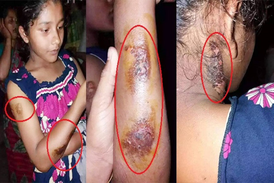 নির্যাতিত স্কুল ছাত্রী