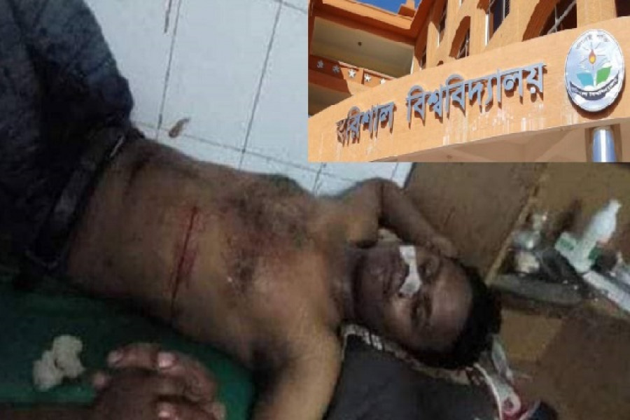 ববি ছাত্রের পেটে বোতল ঢুকিয়ে দেওয়া হলো, পাকস্থলী ছিদ্র