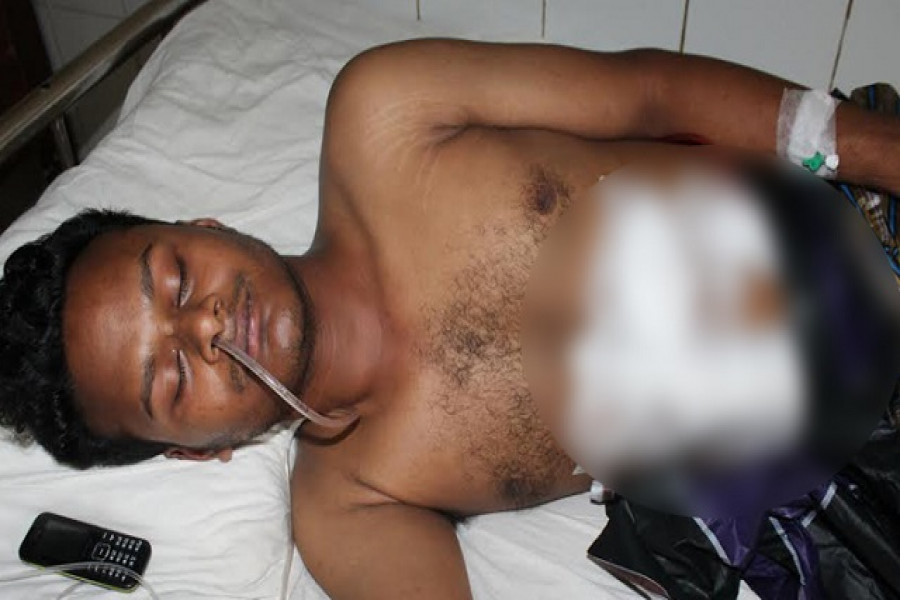 পেটে বোতল ঢুকিয়ে দেয়া সেই শিক্ষার্থী বহিষ্কার 