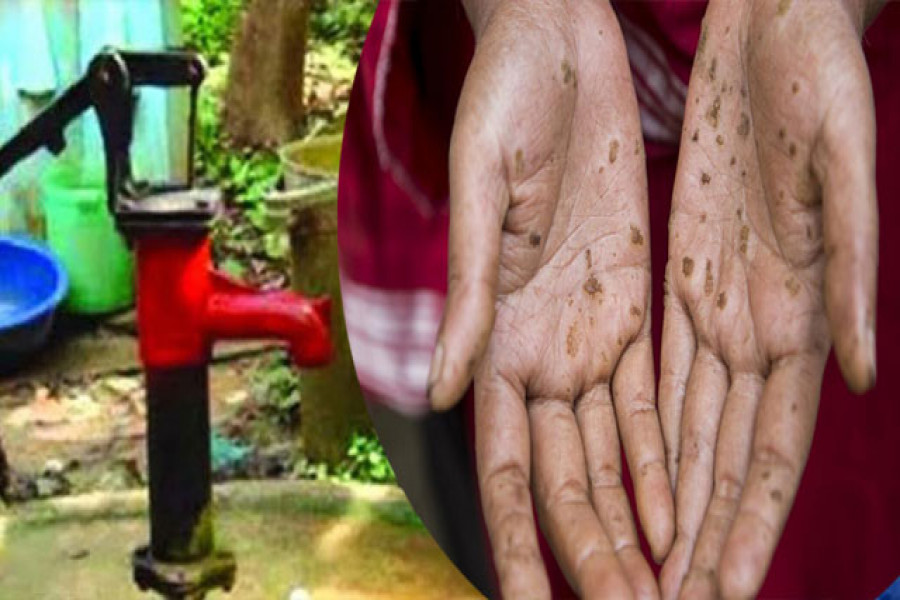 আর্সেনিক আক্রান্ত পুরুষের তুলনায় নারীদের ডায়াবেটিসের প্রবণতা বেশি