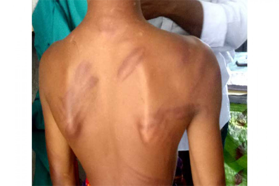 আহত শিক্ষার্থী