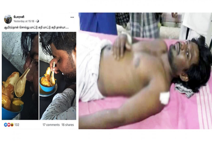 গরুর মাংসের স্যুপ খাওয়ার ছবি শেয়ার, হাসপাতালে যুবক