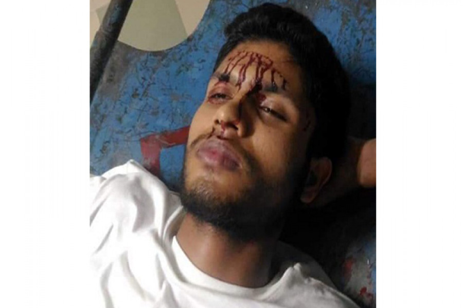 দুর্বৃত্তের ছুরিকাঘাতে হাবিপ্রবি ছাত্র আহত