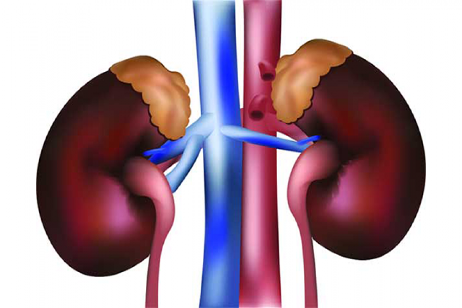 স্বামীর কিডনি বিক্রি করে দিলেন স্ত্রী