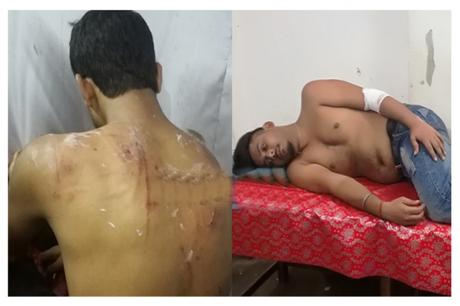 ছাত্রলীগ নেতাদের ওপর হামলা, আহত ৪