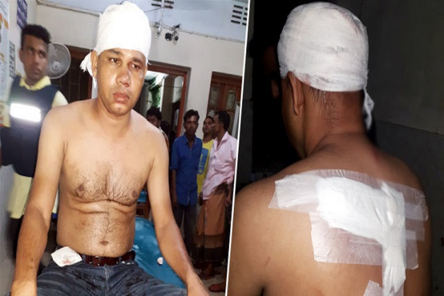 ওসি-এসআইকে কুপিয়ে জখম করলেন ছাত্রলীগ নেতা