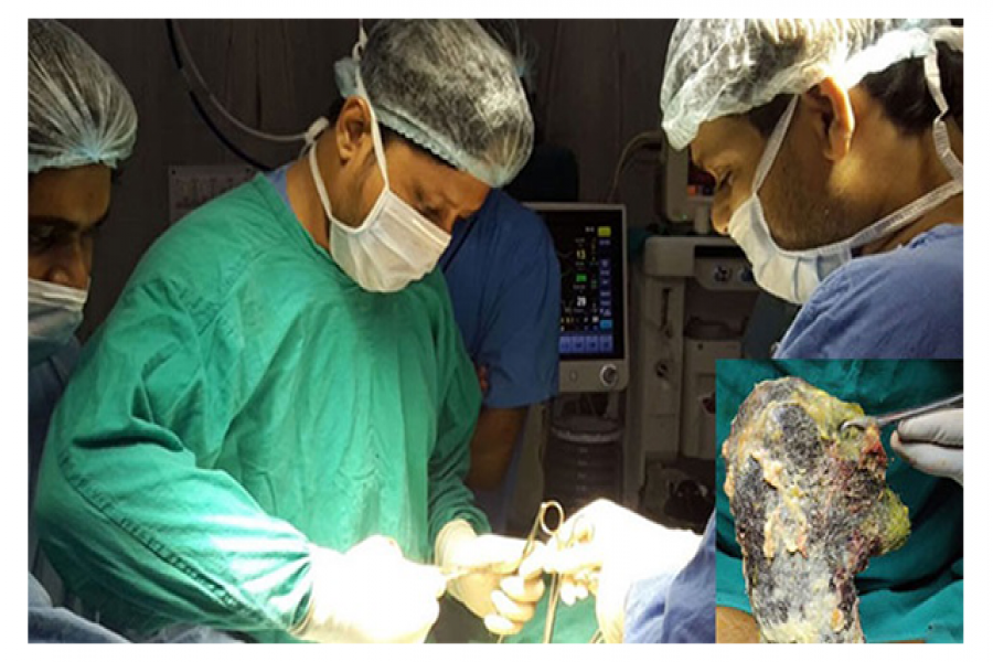 কিশোরীর পেট থেকে বেরোলো ১ কেজি চুল!