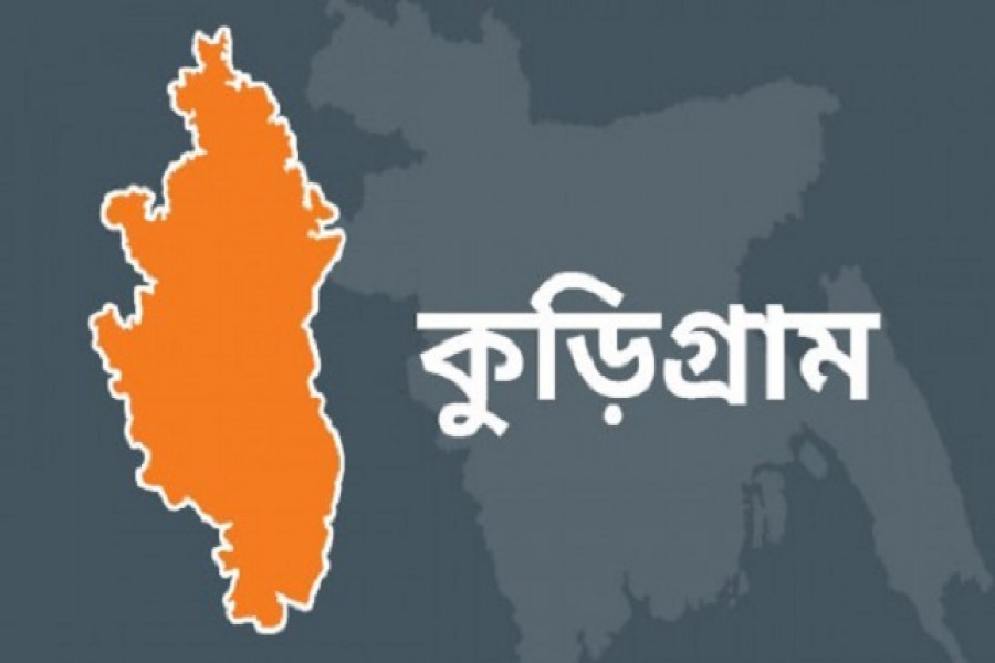 যৌতুকের টাকা না পেয়ে স্ত্রীর গায়ে আগুন