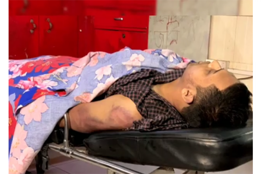 ফাহাদকে পিটিয়ে হত্যা করা হয়েছে: চিকিৎসক