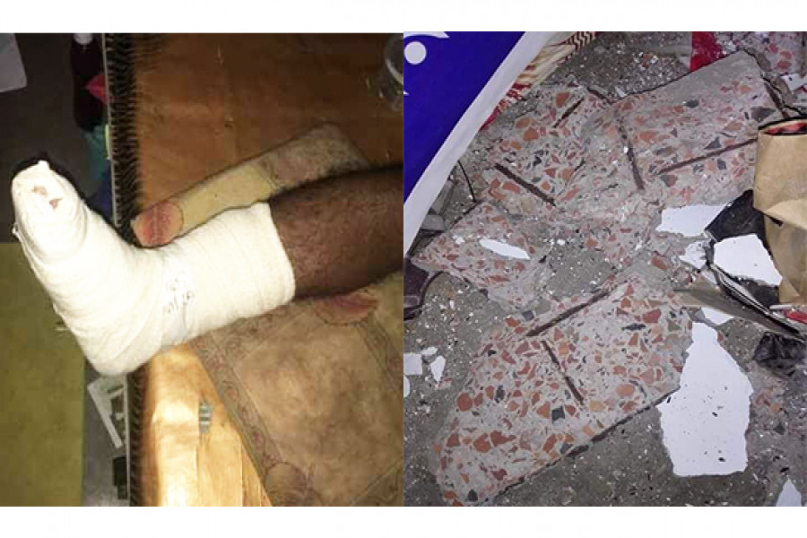 ঢাবিতে ঘুমন্ত ছাত্রদের গায়ে খসে পড়ল পলেস্তারা