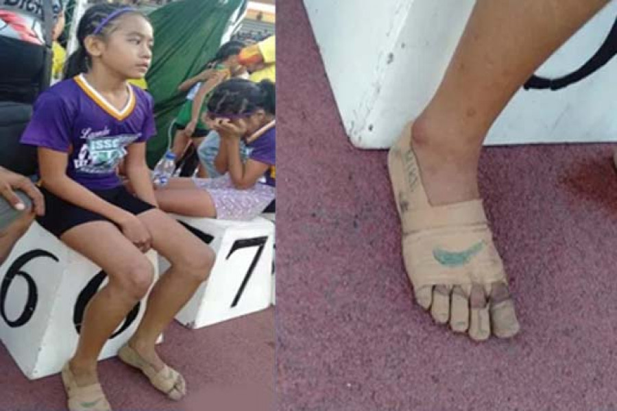 পায়ে ব্যান্ডেজ জড়িয়ে ৩ সোনার মেডেল