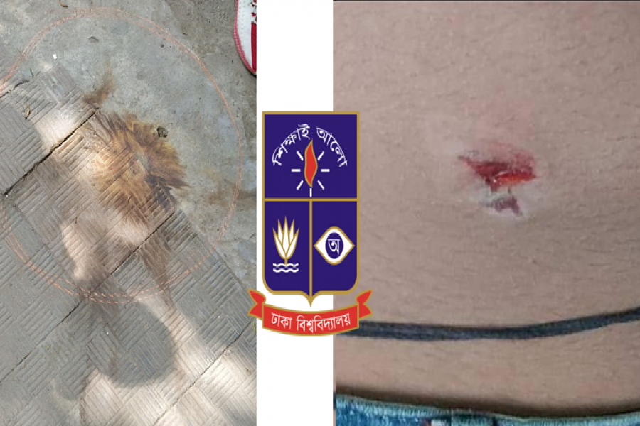 আজও ককটেলে কেঁপে উঠল মধুর ক্যান্টিন, আহত ১