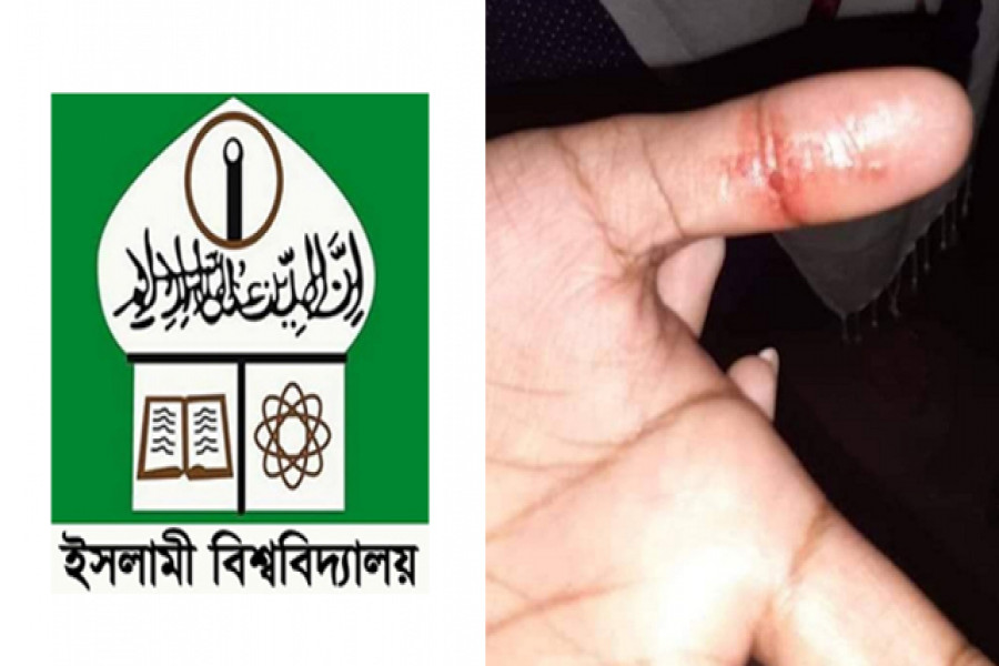 ছিনতাইয়ের শিকার ইসলামী বিশ্ববিদ্যালয়ের ছাত্রী