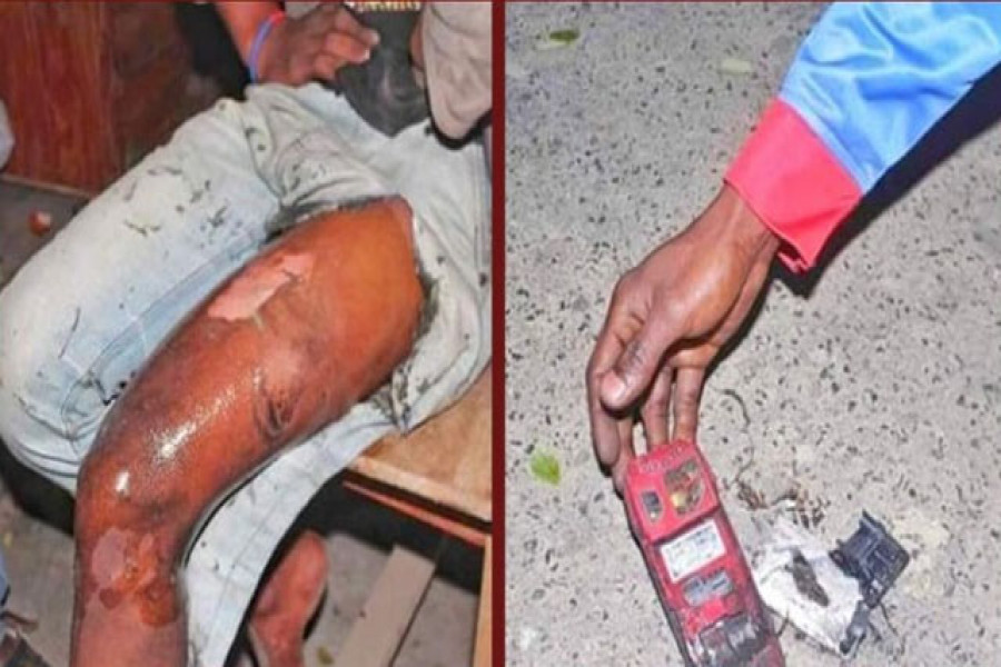 পকেটে মোবাইল বিস্ফোরণে যুবক আহত