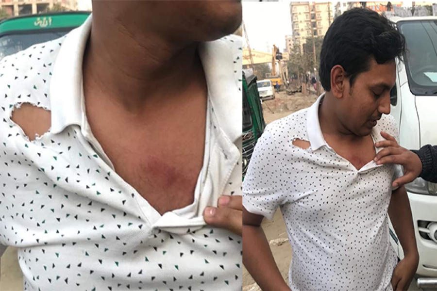 আহত ছাত্রদল নেতা আনিসুর রহমান খন্দকার অনিক