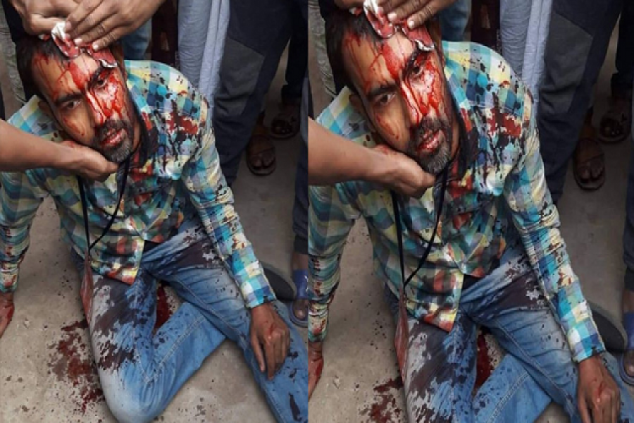 সেই সাংবাদিককে দেখতে হাসপাতালে তাবিথ-ইশরাক