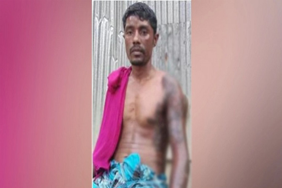 ফুটন্ত তেলে যুবককে ঝলসে দিলেন ইউপি সদস্য