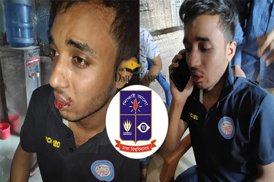 হাফ ভাড়া দেয়ায় ঢাবি ছাত্রকে মেরে রক্তাক্ত