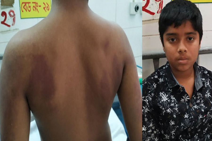 পড়া ভুল হওয়ায় ছাত্রকে পিটিয়ে জখম করলেন শিক্ষক