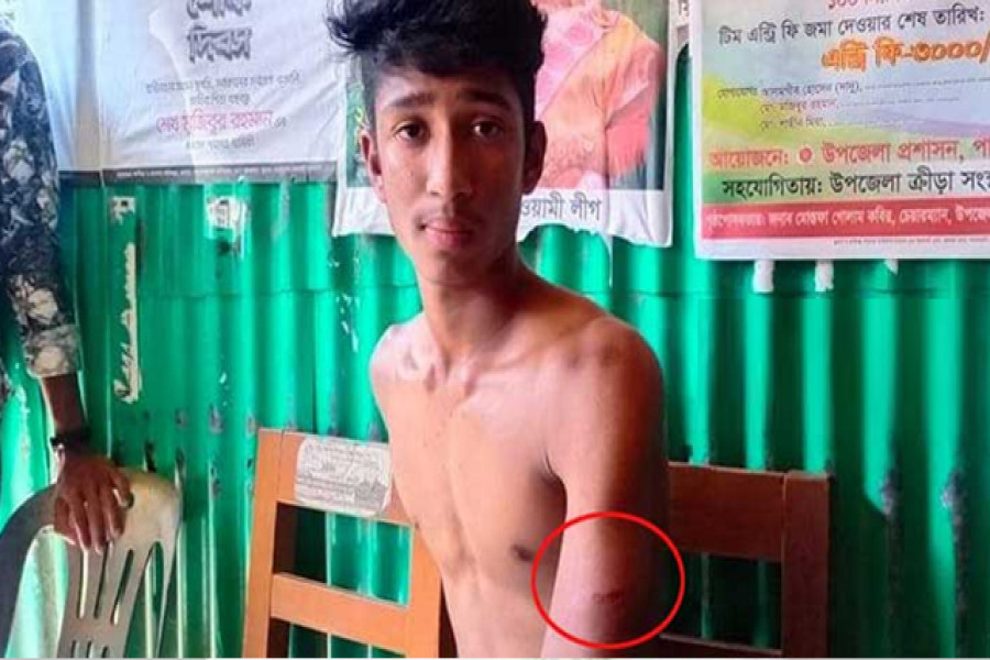 ক্লাসে মোবাইল নিয়ে আসায় ছাত্রকে পিটিয়ে জখম