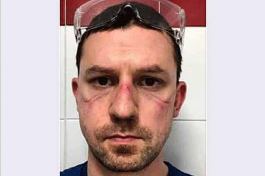 করোনায় মৃত্যুর হৃদয়বিদারক বর্ণনা ইতালির চিকিৎসকের