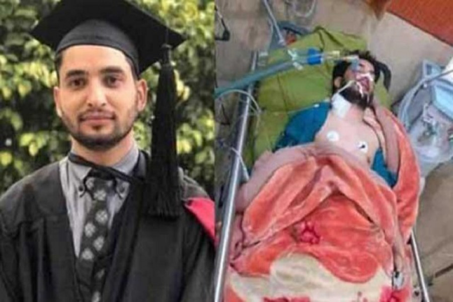 মৃত্যুর ৩০ মিনিট আগে করোনা নিয়ে ভয়ঙ্কর বার্তা চিকিৎসকের