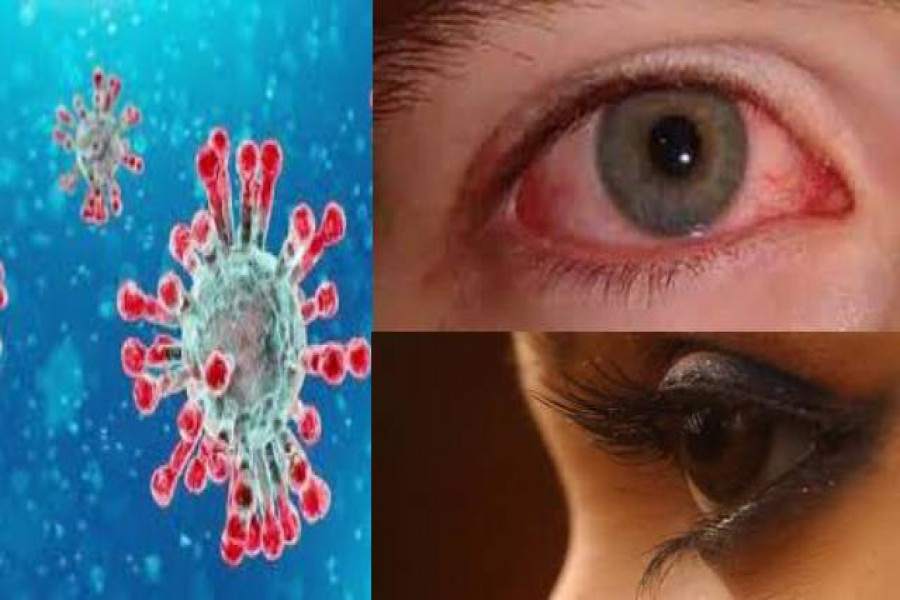 চোখই বলে দেবে আপনি করোনায় আক্রান্ত কিনা