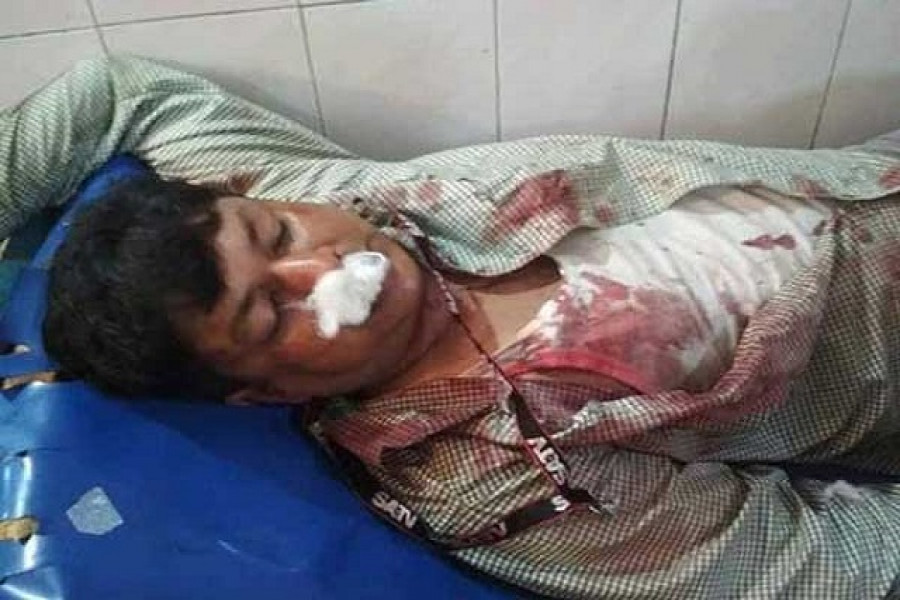 সাংবাদিককে নিজ হাতে পিটিয়ে রক্তাক্ত করলেন চেয়ারম্যান